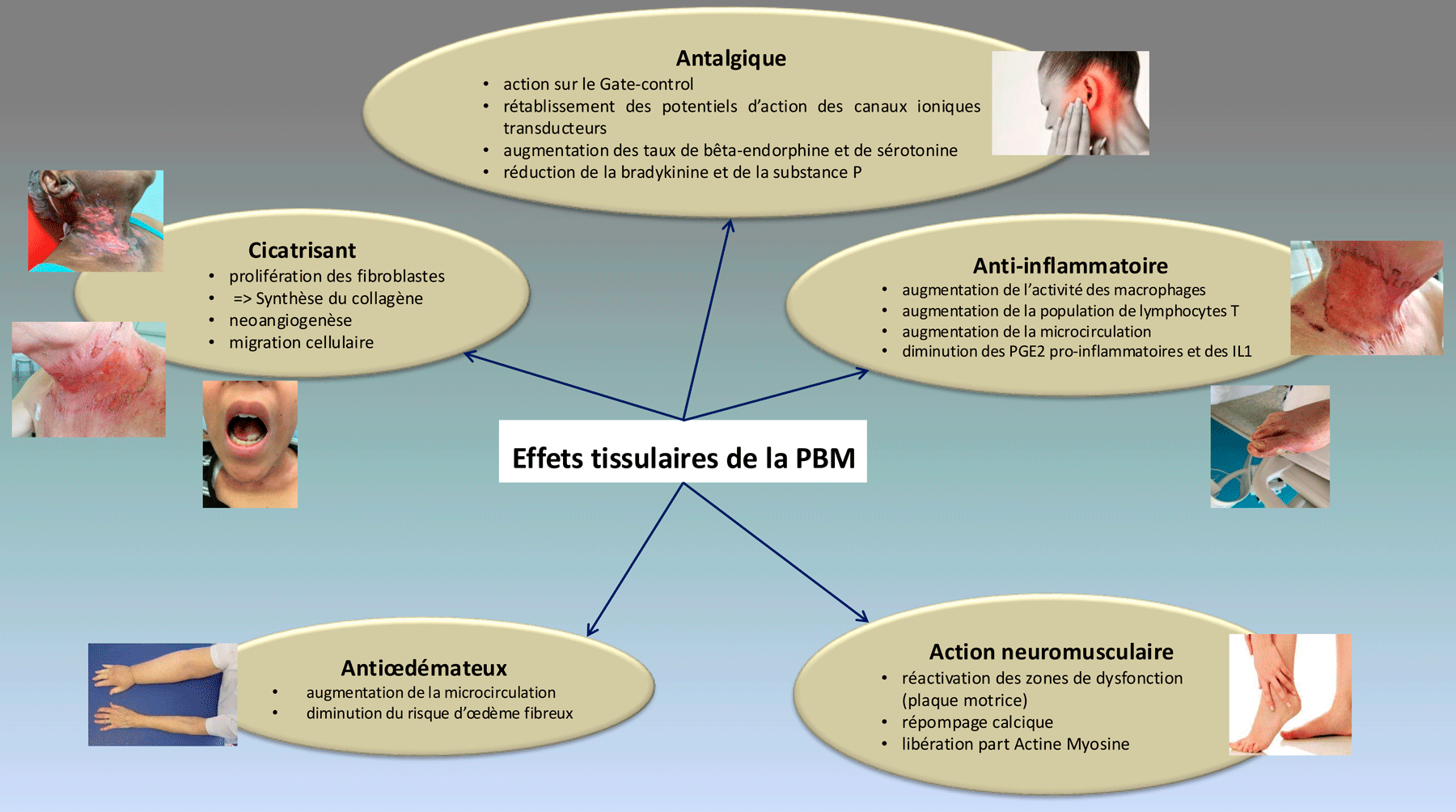Effets tissulaires de la photobiomodulation PBM dans soins du cancer