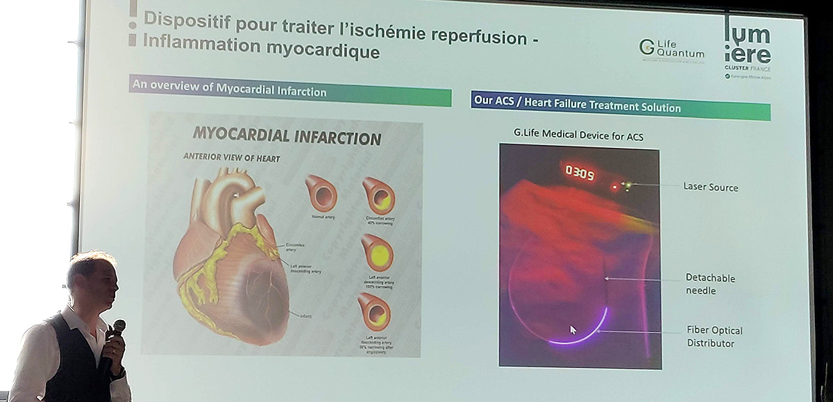 Dispositif lumineux PBM contre l'infactus du myocardique