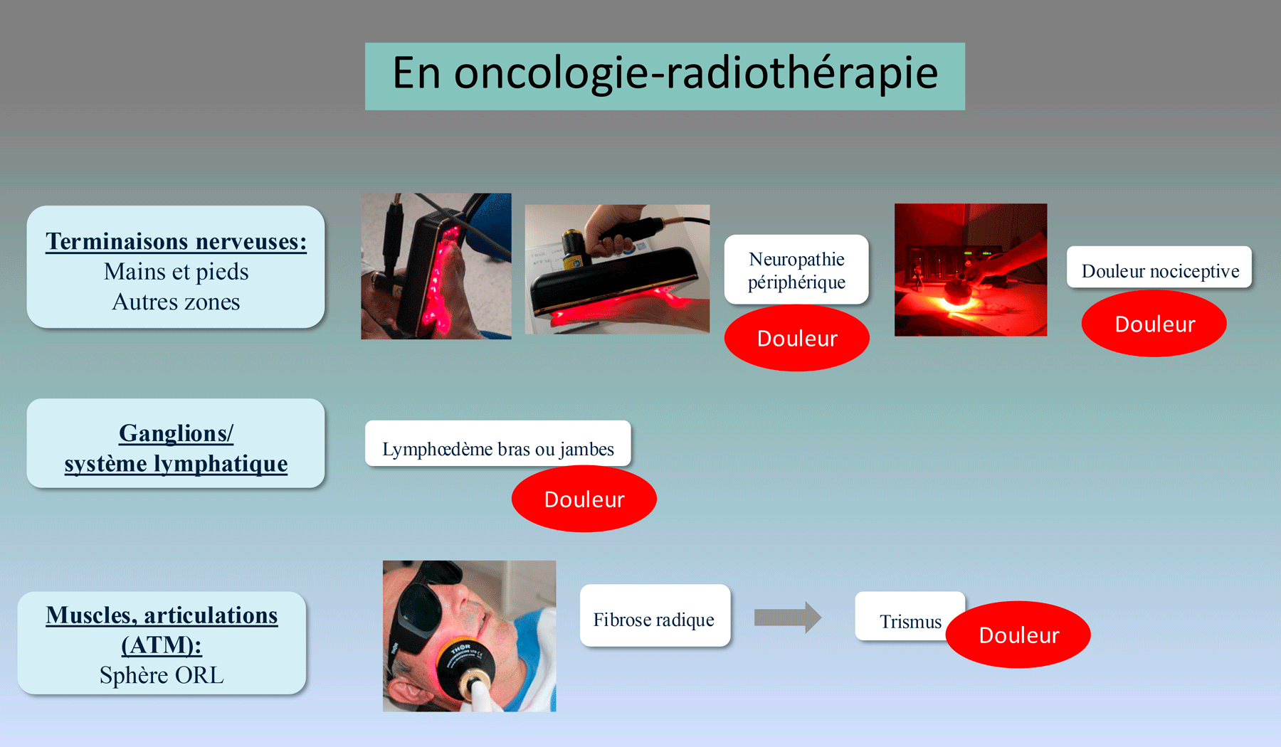 Usages de la Photobiomodulation PBM dans soins du cancer